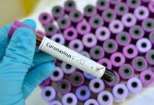 Photo of 6 confirmed cases of Corona Virus in Ghana – Govt